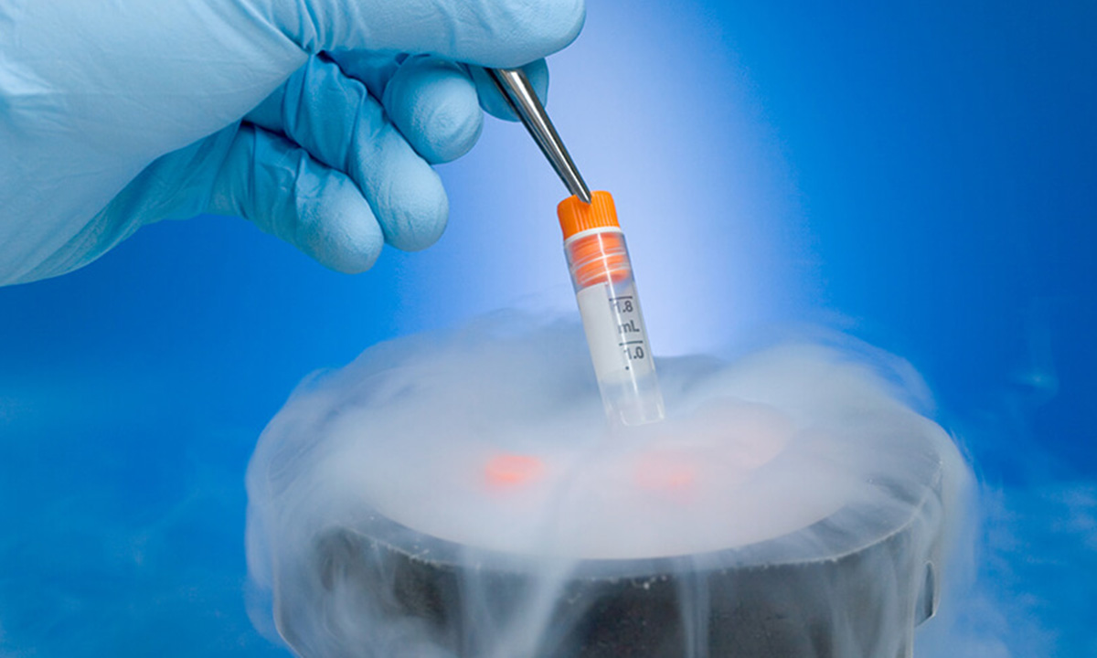 What Is the Best Age for IVF Treatment?